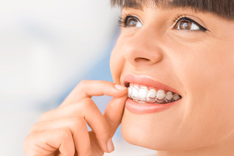 Quality Dental Treatments in La Grange